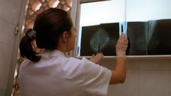 La supervivencia al c�ncer de mama sube al 93% si se detecta en el cribado