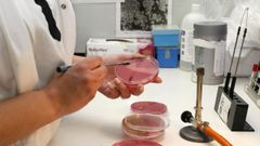 El estudio se realiz� a partir de muestras de la bacteria E. Coli, en la foto