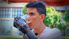 Rub�n, el joven con una mano bi�nica