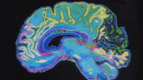 Imagen de la radiograf�a de un cerebro.