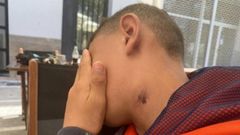 El n�mero borrado que impide a Aymen, de 13 a�os, volver con su madre