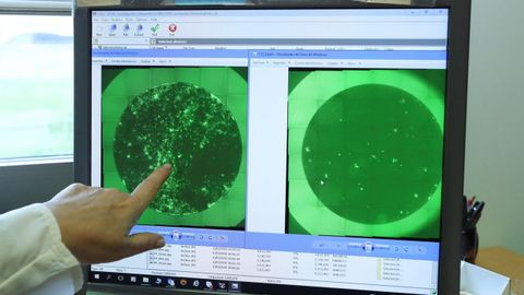 C�lula infectada por el coronavirus