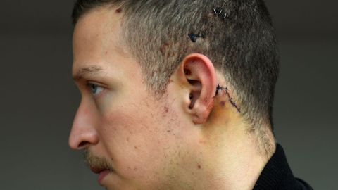 Kevin Rubio, v�ctima de agresi�n hom�foba en Oviedo.Kevin Rubio, v�ctima de agresi�n hom�foba en Oviedo