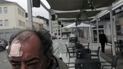 El hombre que sufri� la agresi�n, fotografiado este jueves en la terraza de Chantada en la que tuvo lugar el altercado