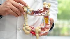 Imagen de archivo de una maqueta de colon