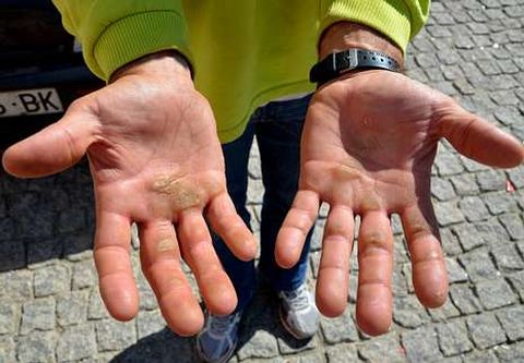 <span lang= es-es >Manos ganadoras</span>. Duras y encallecidas de ganar la Concha, ligas o campeonatos de Espa�a