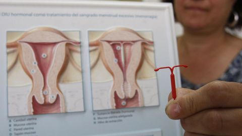 Imagen de archivo de un diu