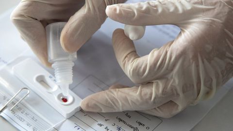 Test r�pido para detectar el coronavirus