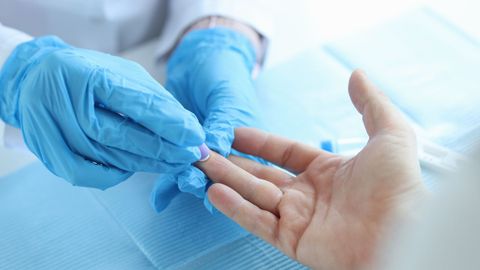 Extracci�n de muestra de sangre de un dedo para una prueba.