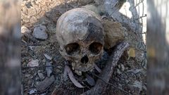 Restos �seos hallados en una maleta en M�laga