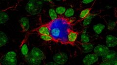La microgl�a (en rojo) responde al tratamiento encapsulando y reduciendo el tama�o de las placas amiloideas (en azul) y protegiendo a las neuronas. Los n�cleos celulares se muestran en verde.