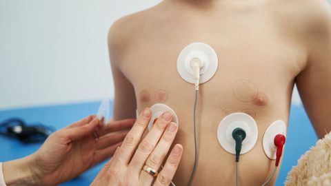 Imagen de archivo de la exploraci�n card�aca de un menor