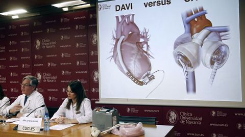 �scar, el primer caso de �xito con un coraz�n artificial total