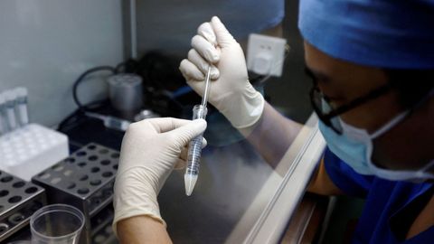 Imagen de archivo de un sanitario manipulando una muestra de semen
