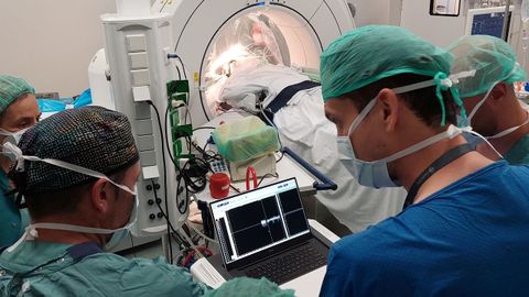 Imagen de la intervenci&oacute;n y del equipo del hospital Sant Pau que particip&oacute; en ella. 