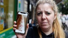 Mar�a Rey muestra en su tel�fono las fotograf�as de c�mo le quedaron las piernas tras la depilaci�n l�ser