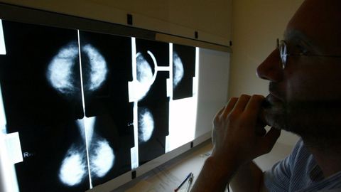 Un m�dico estudia una mamograf�a en el policl�nico La Rosaleda