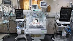 Un beb� prematuro, en el hospital gazat� de Shifa.