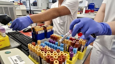 Imagen de archivo del laboratorio de un hospital con muestras de sangre
