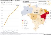 Casos de microcefalia en Brasil