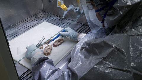 Una t�cnica analizando l�minas de un cerebro. 