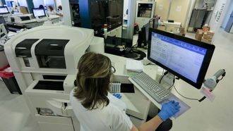 Imagen de archivo de la tecnolog�a empleada en los cribados de hepatitis C.