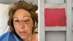 Imagen de la mujer agredida y de la tumba que apareci� abierta en el cementerio