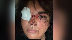 Imagen del estado en el que qued� una mujer transexual tras recibir una�paliza en La Ba�eza (Le�n).