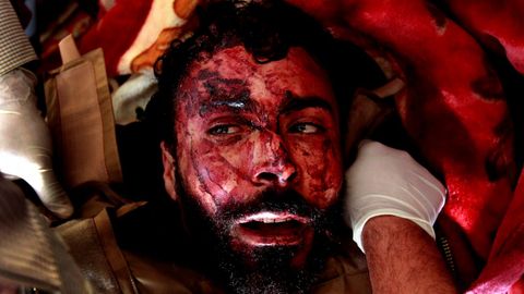 Los m�dicos atienden a un soldado herido, capturado  por combatientes rebeldes, en el hospital de Misrata
