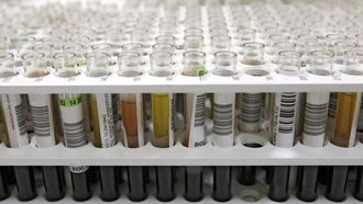 Imagen de archivo del CHUO de varias pruebas de orina.