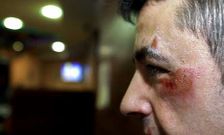 Un hostelero carball�s fue agredido por dos encapuchados en la madrugada del viernes.