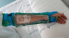 Dispositivo protector para el cat�ter venoso perif�rico