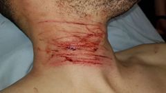 El motorista result� con ara�azos en el cuello, entre otras lesiones