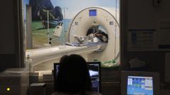 El uso de la IA para analizar im�genes cl�nicas, en la foto un TAC del CHUS, es cada vez m�s frecuente