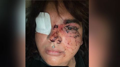 Imagen del estado en el que qued&oacute; una mujer transexual tras recibir una&nbsp;paliza en La Ba&ntilde;eza (Le&oacute;n).