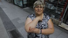Elvira Ameijeiras, vecina de Arteixo, que sufri� una ca�da este lunes