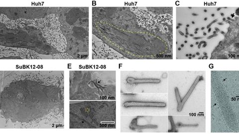 C�lulas y viriones infectados con el virus (recombinante) Lloviu, en las im�genes de un art�culo publicado en Patog 18(2) de PLoS