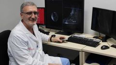 Balbino L�pez Seoane, jefe del Servicio de Radiodiagn�stico del Hospital Ribera Juan Cardona.