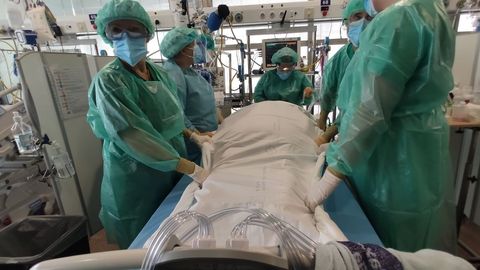 Enfermeras de reanimaci�n del Chuac dando la vuelta a un paciente cr�tico boca-abajo, una de las maniobras m�s arriesgadas.