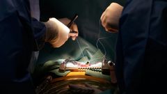 EQUIPO DE CIRUGIA CARDIACA INFANTIL Y CARDIOPATIAS CONGENITAS CON EL DR.PORTELA
QUIROFANOS
OPERACION
CHUAC
