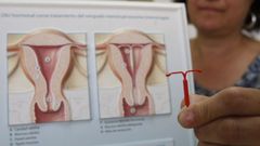 Imagen de archivo de un diu