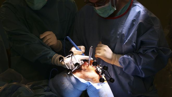 Aumentan las cirug�as en quir�fanos robotizados, en la foto una intervenci�n de rodilla en Santiago el pasado 6 de octubre