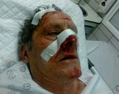 El agredido, en la foto, ya se encuentra en su casa recuper�ndose