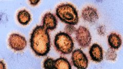 La vacuna podr�a ser eficaz frente a todo tipo de coronavirus, como el SARS-CoV-2, en la imagen, que causa el covid