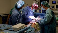 El Chuac fue en el 2023 el tercer hospital de Espaa en nmero de trasplantes de corazn. En la imagen, Jos Cuenca, jefe de ciruga cardaca, durante una operacin