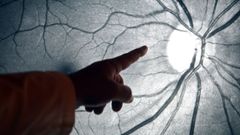 Vista de una imagen de los nervios del ojo