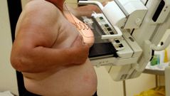 Las mamograf�as para la detecci�n precoz del c�ncer en A Mari�a se concentran en el Hospital da Costa