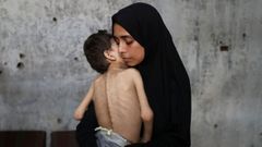 Una mujer sostiene a su hijo, que sufre desnutricin, en un refugio de Ciudad de Gaza