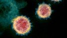 Imagen del coronavirus SARS-CoV-2