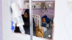 Un ni�o palestino recibe tratamiento en un hospital de Gaza.